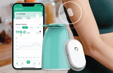 CGM